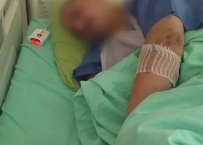 Jelgavas novadā gaļas mašīnā smagi traumēta vīrieša roka